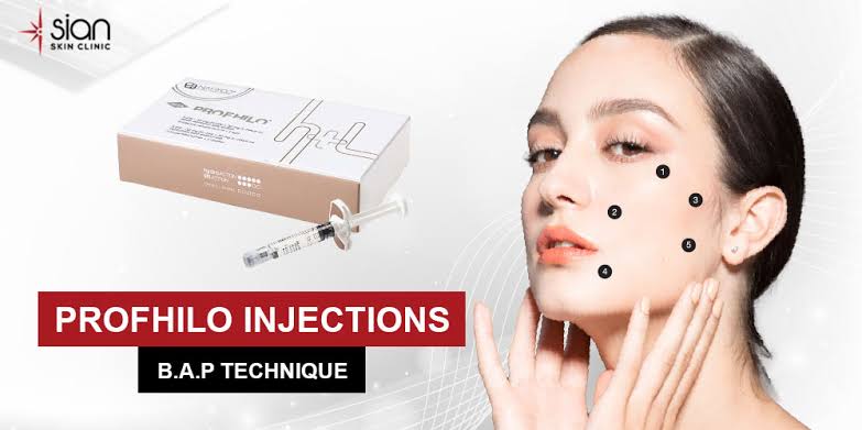 Nước hoa nữ Armaf La Rosa EDP 100ml