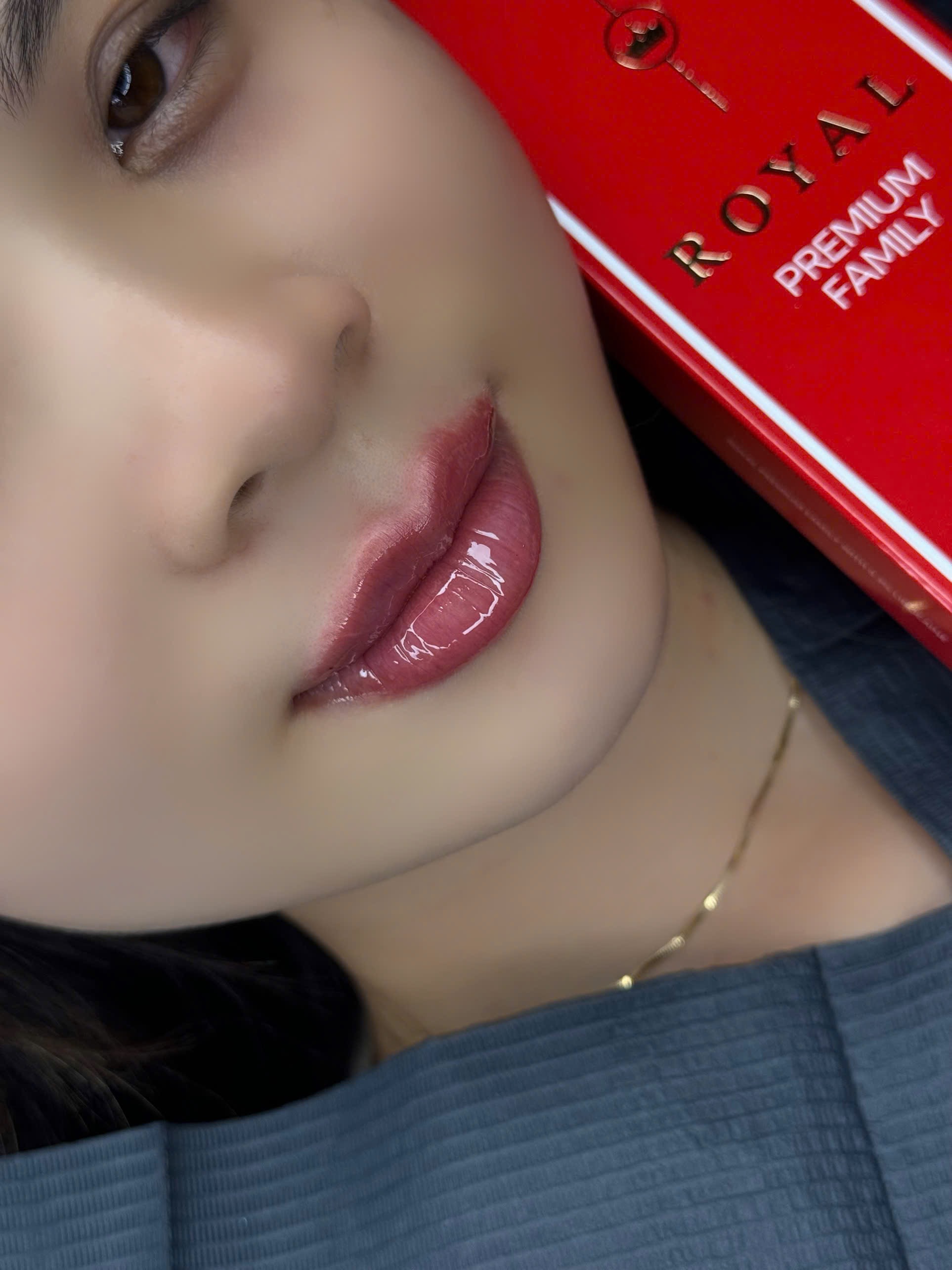 Ảnh nhỏ 2